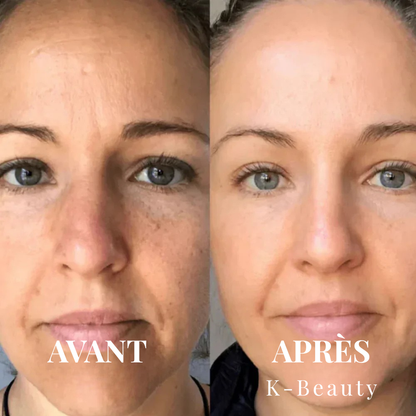 K-Beauty™ - Peel Shot | Le Sérum Coréen Exfoliant au Riz