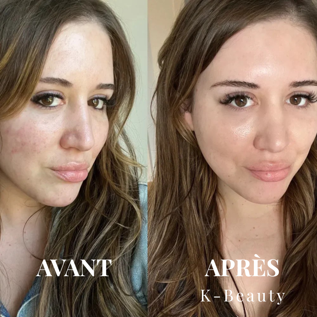 K-Beauty™ - Peel Shot | Le Sérum Coréen Exfoliant au Riz