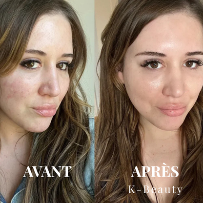 K-Beauty™ - Peel Shot | Le Sérum Coréen Exfoliant au Riz