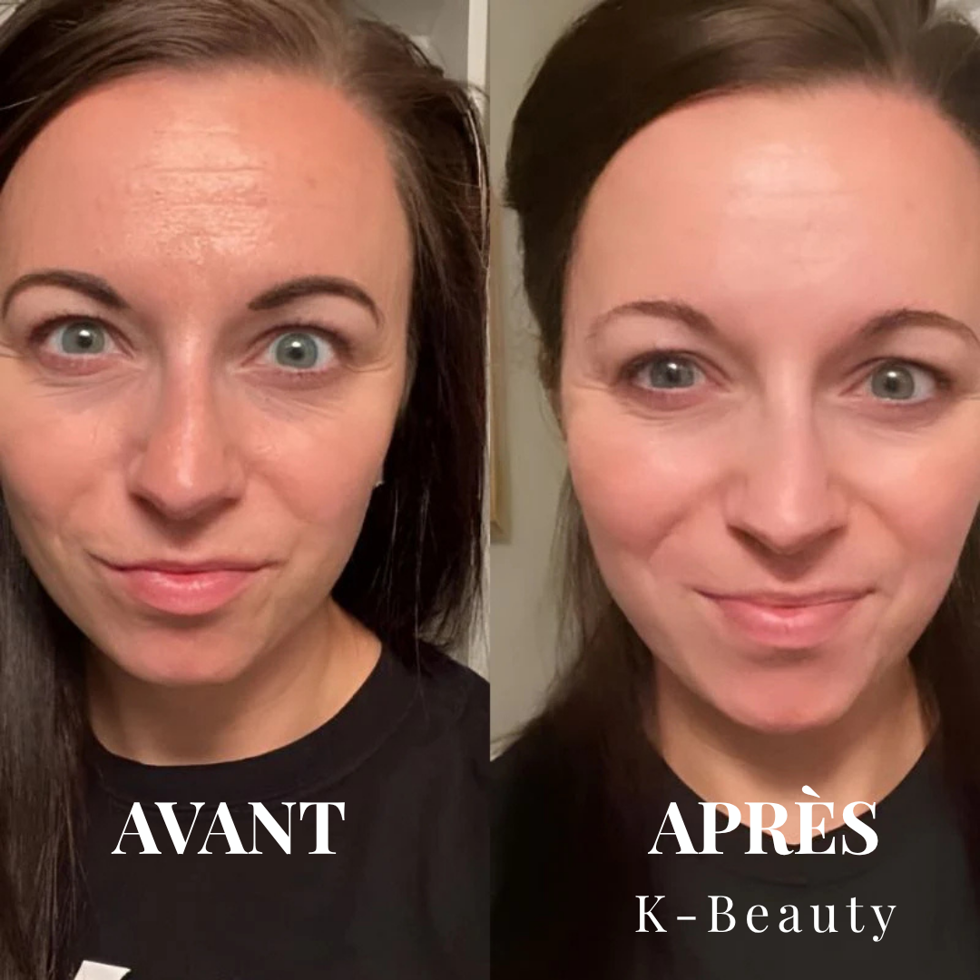 K-Beauty™ - Peel Shot | Le Sérum Coréen Exfoliant au Riz